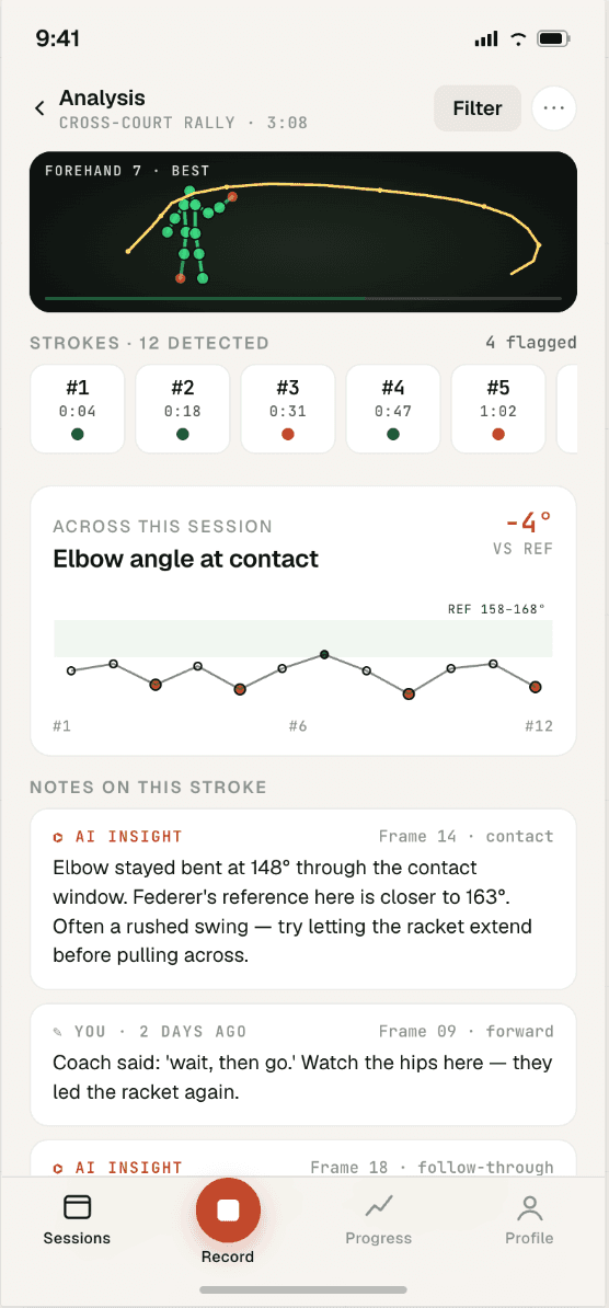 StrokeVision stroke analysis screen with skeleton overlay, per-stroke trend, and coaching notes